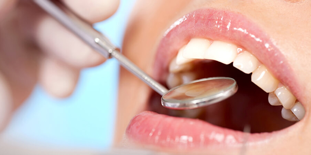 歯を守る予防歯科